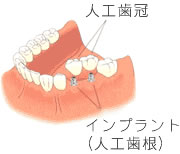 Cvgɂ鎡Ö@